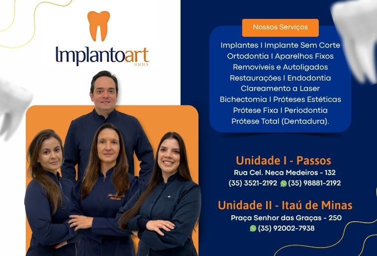   IMPLANTOART
